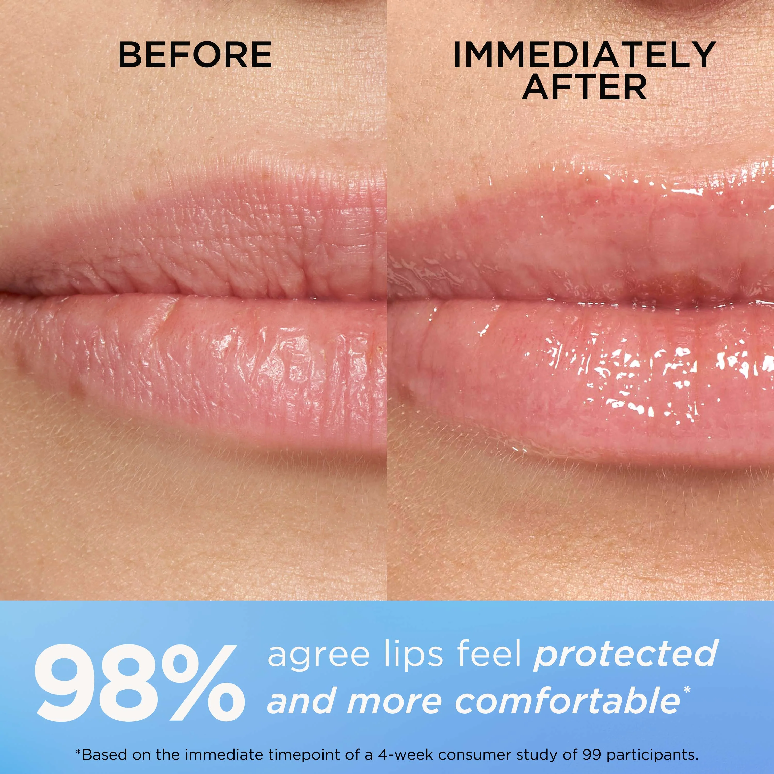 Eight Hour Cream Intensive Lip Repair Balm - Image 9