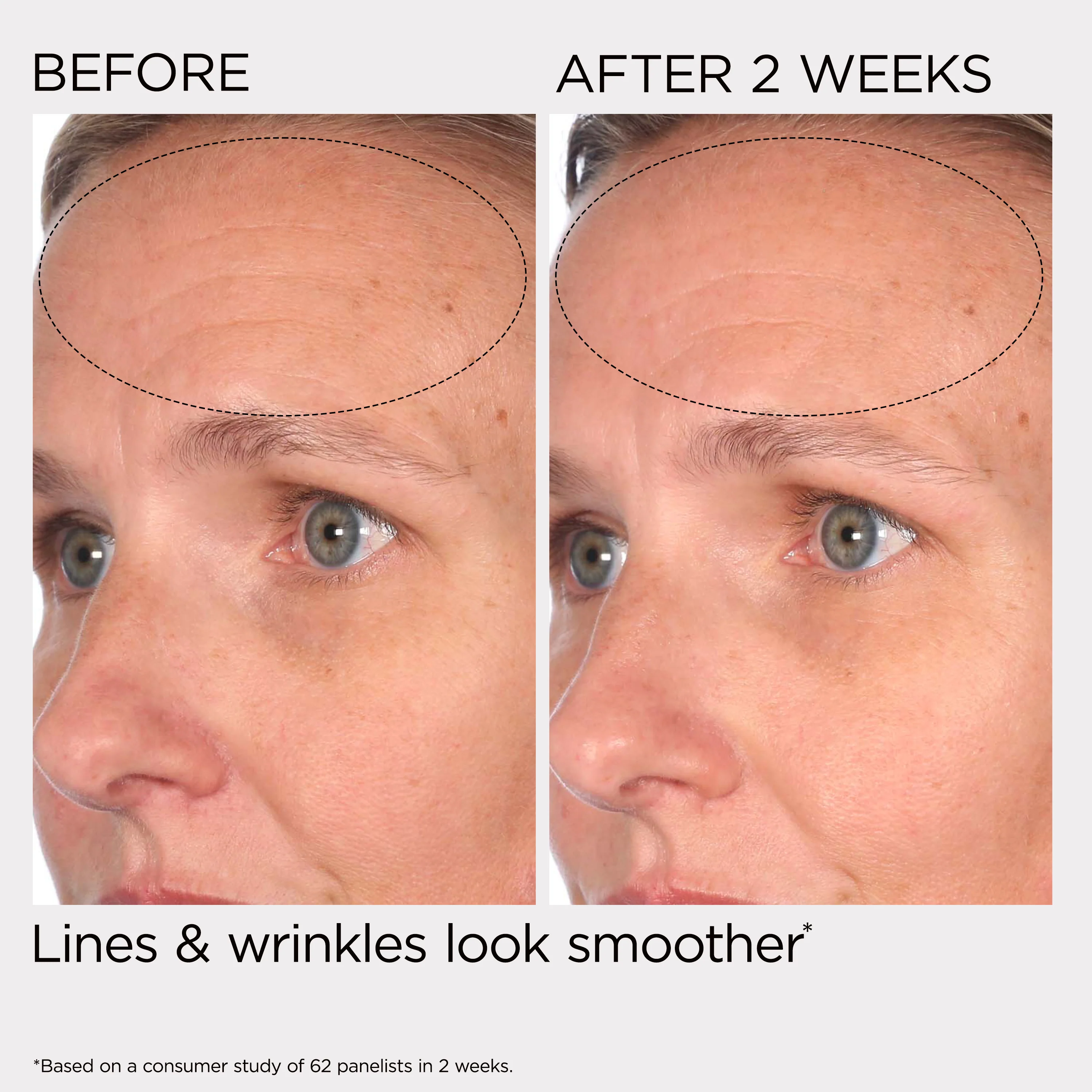 PREVAGE® Multi-Restorative Day Cream With Sunscreens - Image 7