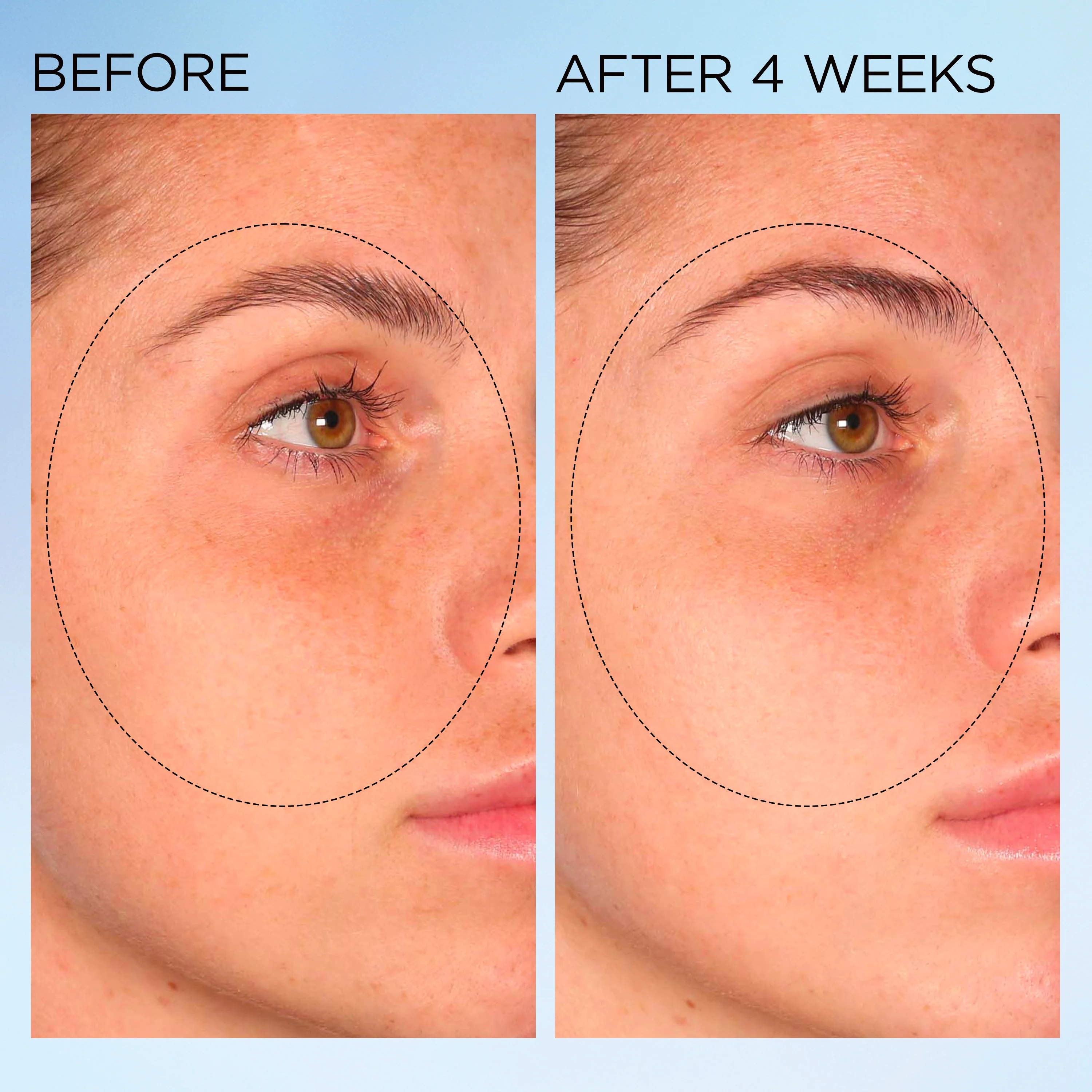 Visible Brightening Clearly Radiant Spot Correcting Capsules - Image 10