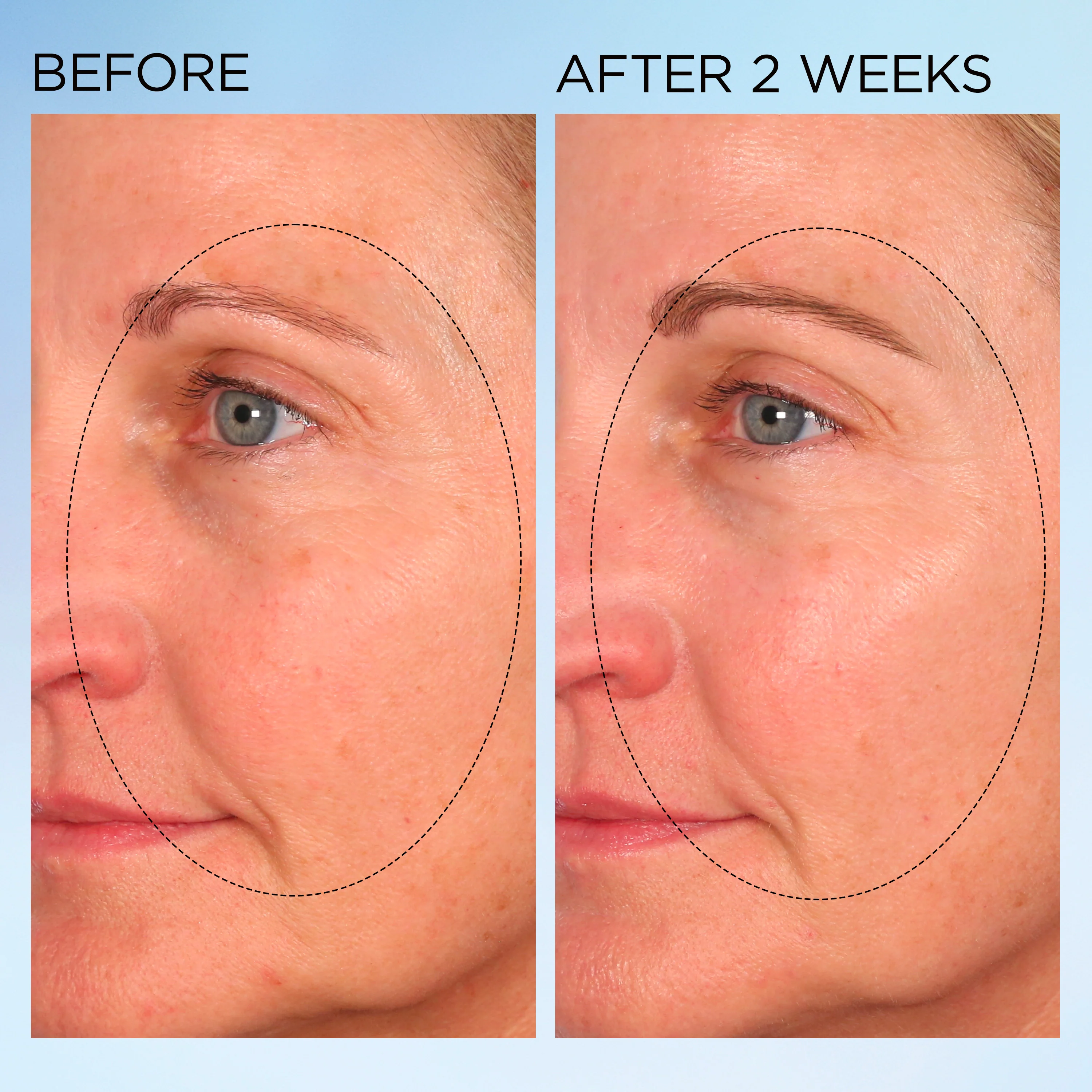 Visible Brightening Clearly Radiant Spot Correcting Capsules - Image 9